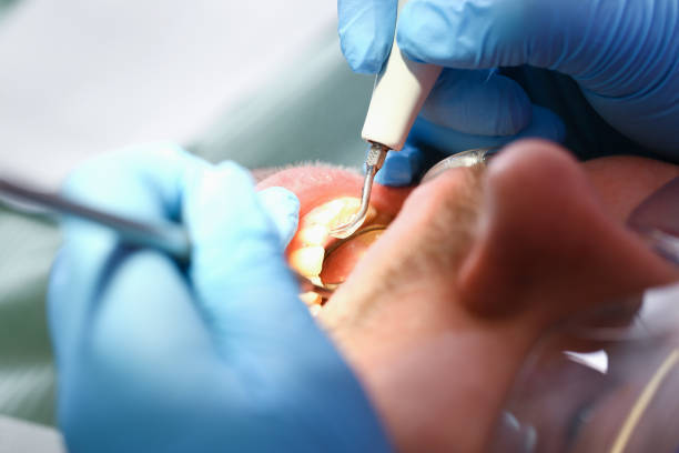 Best Weekend Emergency Dentist in Atwood, IL