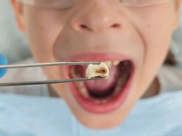 Best Orthodontic Emergency Dentist in Atwood, IL